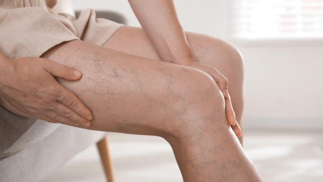 Moje nogi: 7 niepokojących objawów których nie możesz ignorować